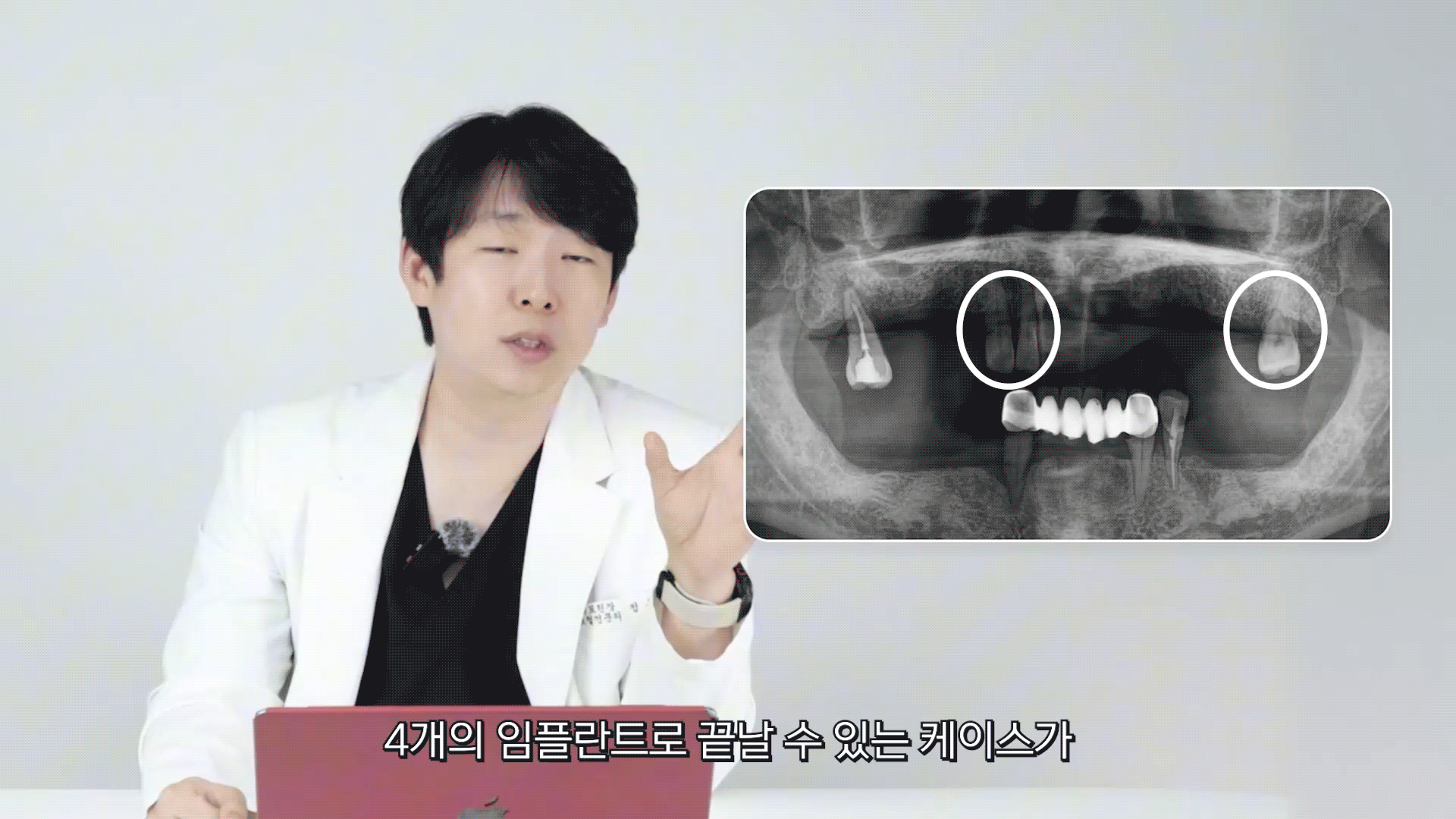 유튜브 영상 1건으로 월매출 1억 달성한 치과 원장님